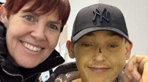 Man, 25, turned bright ‘Bart Simpson’ yellow after going to bed feeling unwell