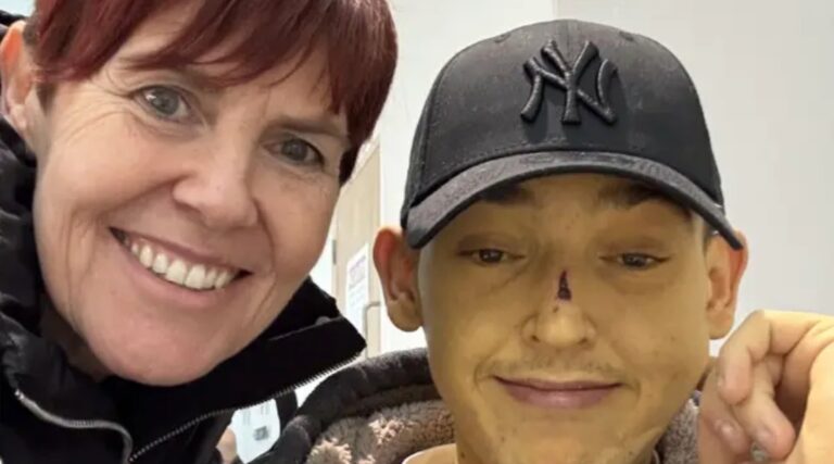 Man, 25, turned bright ‘Bart Simpson’ yellow after going to bed feeling unwell
