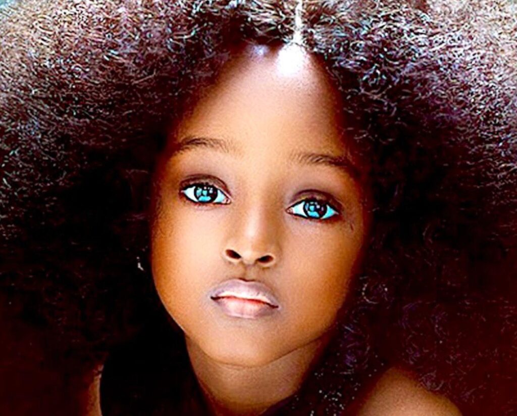 When She Was 5 She Had ‘The Most Beautiful Face In The World’ But Wait Till You See Her Today