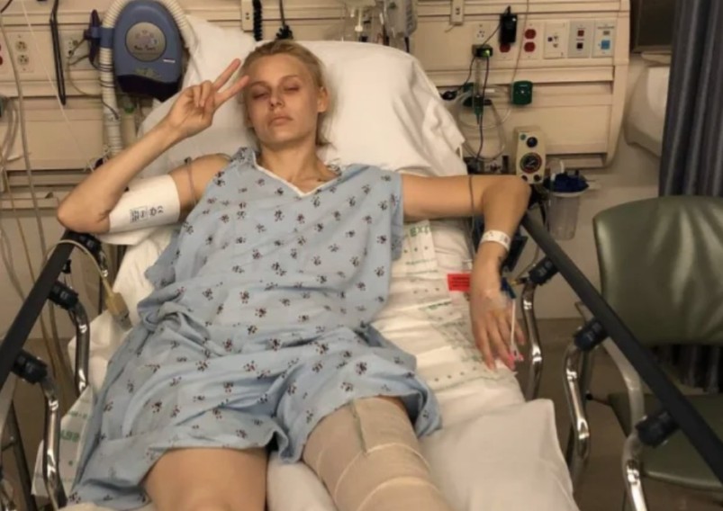 Woman Loses Her Legs Due To Common Household Product, Now She’s Warning Women Everywhere