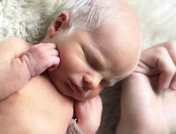 Albino baby mocked for white hair is happy and healthy years later.