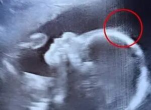Doctors couldn’t believe what they saw during the ultrasound