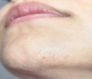 Surprised by Chin Whiskers? You’re Not Alone
