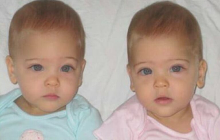 Dubbed ‘the most beautiful twins in the world:’ this is what the Clements sisters look like today
