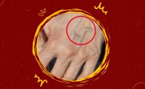 What Does It Mean to Have Visible Veins