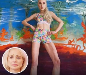 Woman Spends $161K To Have Legs Extended 5.5″ – Lives To Regret It