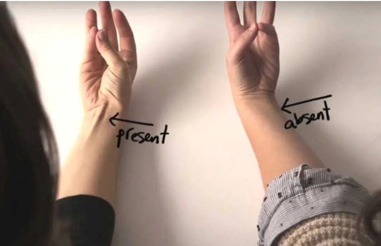 What It Means If You Have Arm Tendon