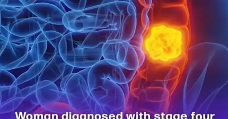 Woman reveals 5 colon cancer symptoms that shouldn’t be ignored