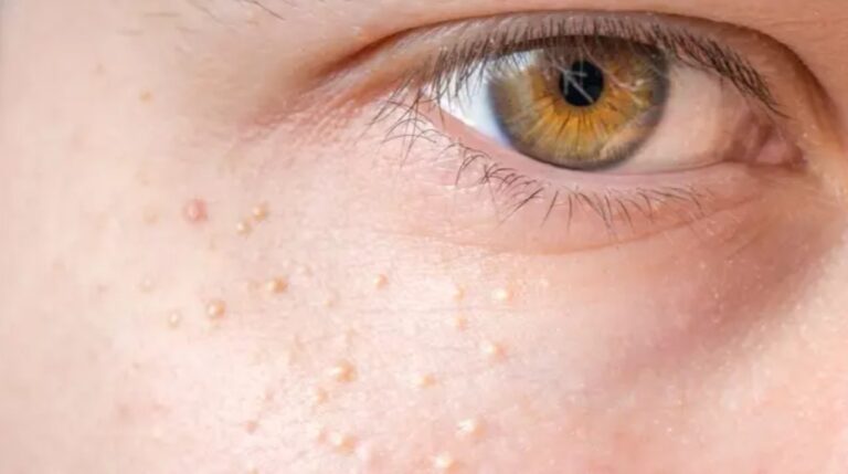 Experts issue serious warning to people with series of white spots on their body and private parts