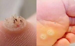 Be very careful if it comes out in your mouth, you are!