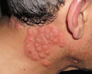 Why many experts advise against sleeping with window open