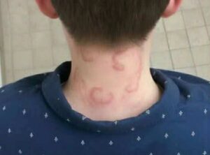 My 8-year-old has been experiencing this for two months — and it’s getting worse