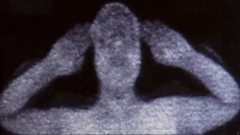 Man’s warning after seeing what popped up on airport scanner when he went through with erection