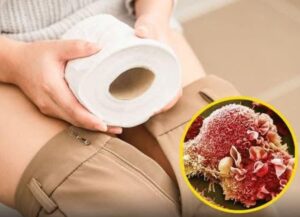 Hidden PFAS in toilet paper linked to cancer risk: 6 types to be aware of