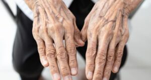 If you see someone with bulging veins, you must tell them these things