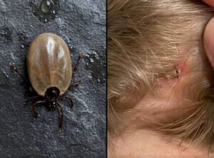 Does anyone know what kind of insect this is? I just found it on my son’s head…