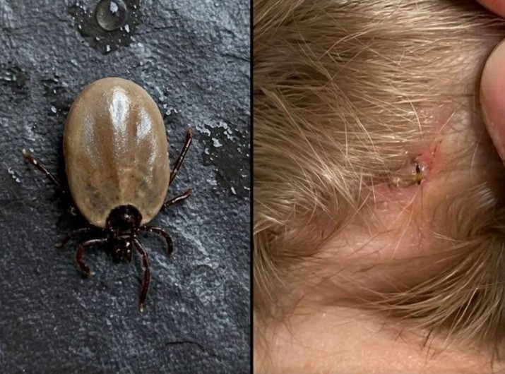 Does anyone know what kind of insect this is? I just found it on my son’s head…