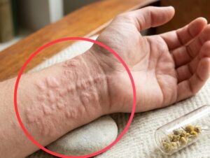 My son has been experiencing this for two months — and it’s getting worse