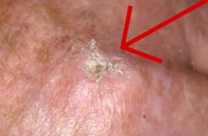 These Are the First Symptoms of a…