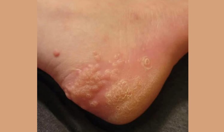 These are the consequences of wearing used…