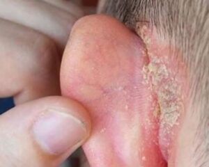 I found a strange patch of skin on my son’s ear this morning. His doctor appointment is a week away — what should I do meanwhile?