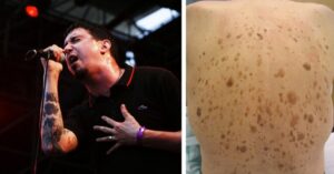 These are the symptoms of adenocarcinoma cancer to look out for after beloved rock icon dies at 59