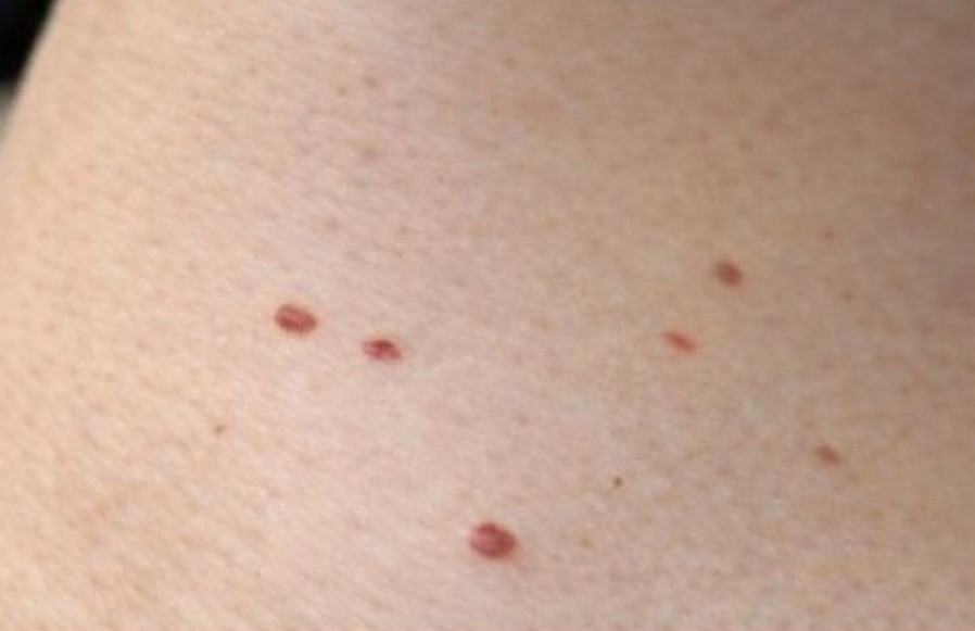 Red Dots on Your Skin: Causes and What They Could Mean…