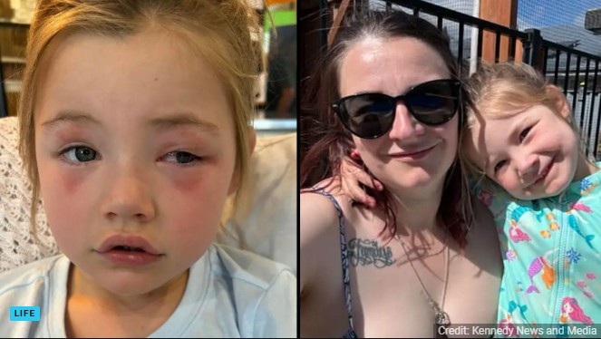 Toddler, 4, Blinded After Biting Common Household Item Mom Gave Her To Hold