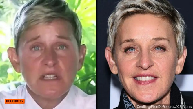 What Has Ellen Degeneres Been Diagnosed With? Triple Diagnosis Explained